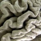 03_01_brain_square_2.jpg