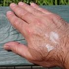 beesting_150.jpg
