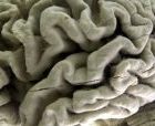 brain.jpg