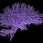 brain_3.jpg